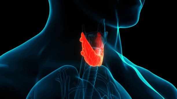 laryngeal cancer