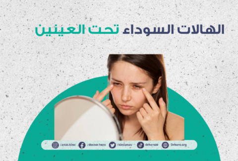 الهالات السوداء