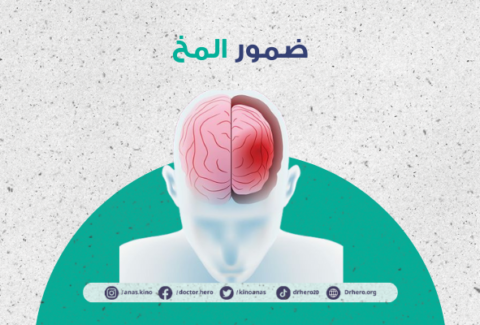 ضمور المخ