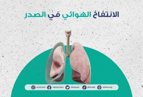 استرواح الصدر