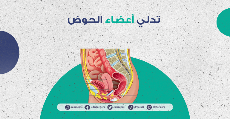 تدلي أعضاء الحوض