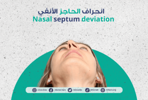 انحراف الحاجز الأنفي