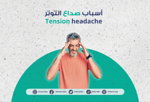 صداع التوتر