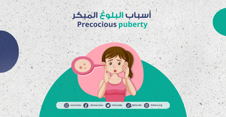 البلوغ المبكر | الأسباب، والأعراض، والعلاج