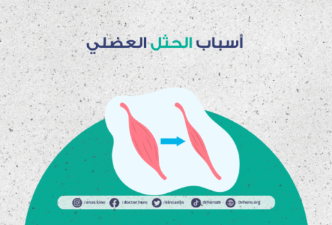 الحثل العضلي