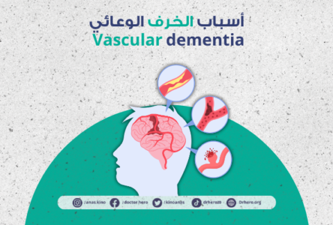 الخرف الوعائي