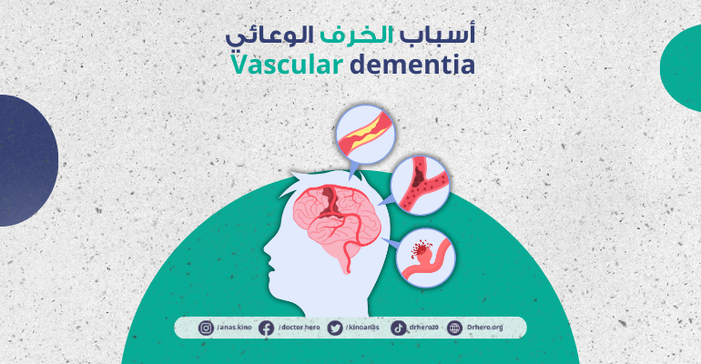 الخرف الوعائي