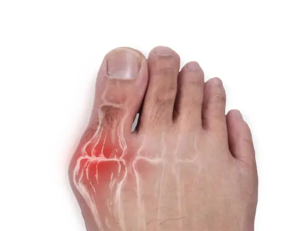 دواعي استعمال ميجاليز