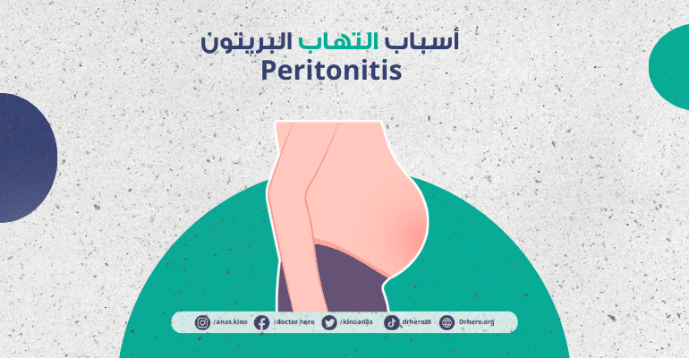 التهاب البريتون