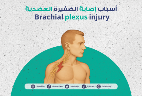 إصابة الضفيرة العضدية