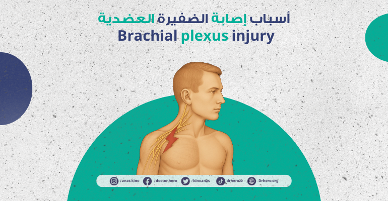 إصابة الضفيرة العضدية