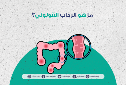 الرداب القولوني
