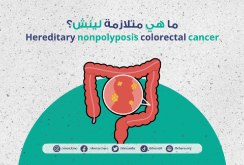 متلازمة لينش