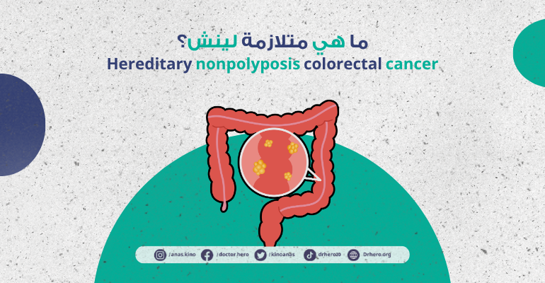 متلازمة لينش