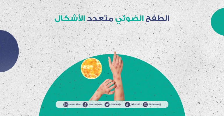 الطفح الضوئي متعدد الأشكال