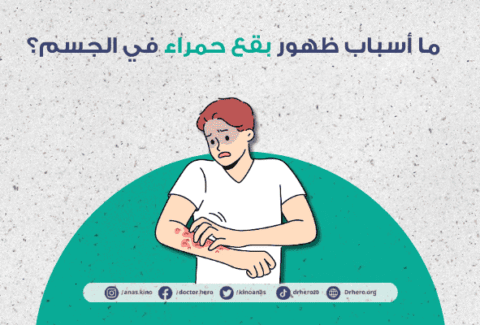 بقع حمراء في الجسم