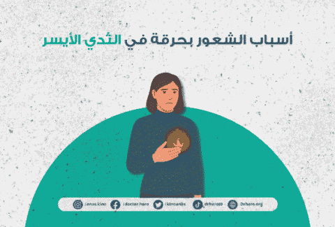 ألم كالحرق في الثدي الأيسر