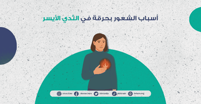 ألم كالحرق في الثدي الأيسر