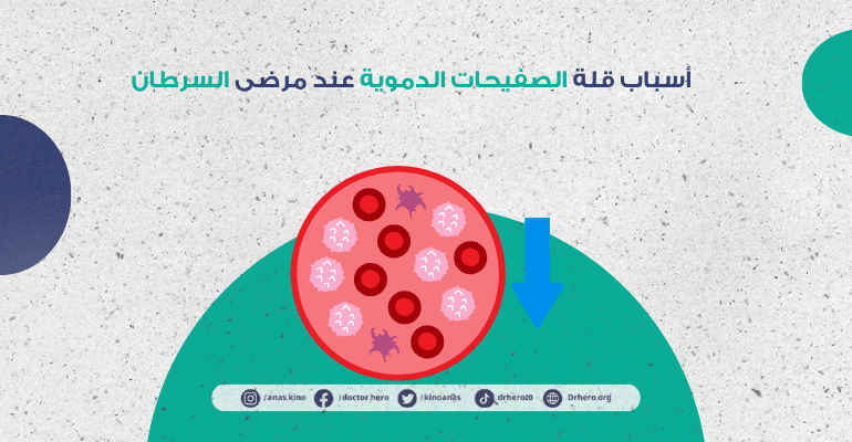نقص الصفائح الدموية عند مرضى السرطان