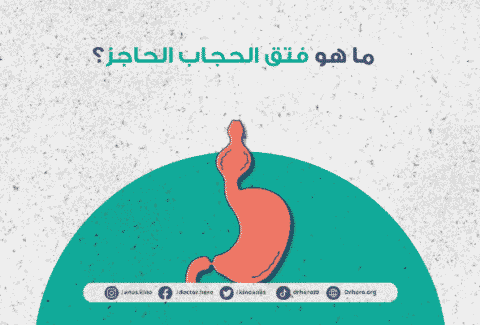 أعراض فتق الحجاب الحاجز