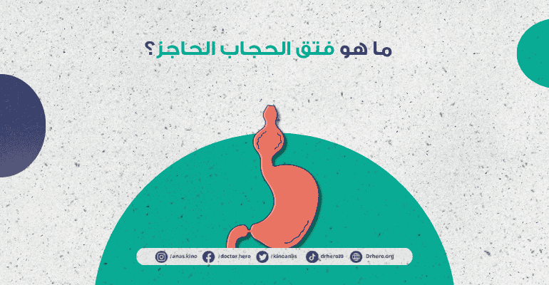 أعراض فتق الحجاب الحاجز