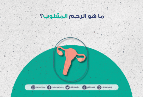 الرحم المقلوب
