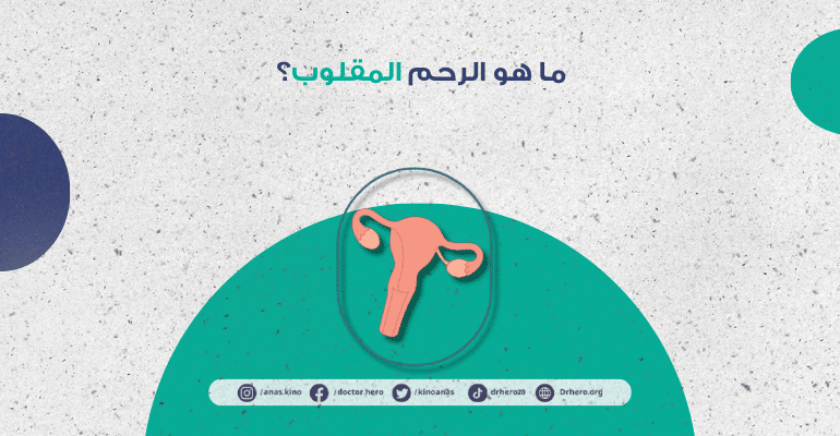 الرحم المقلوب