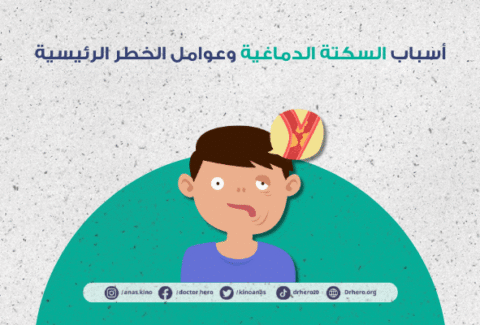 أسباب السكتة الدماغية وعوامل الخطر