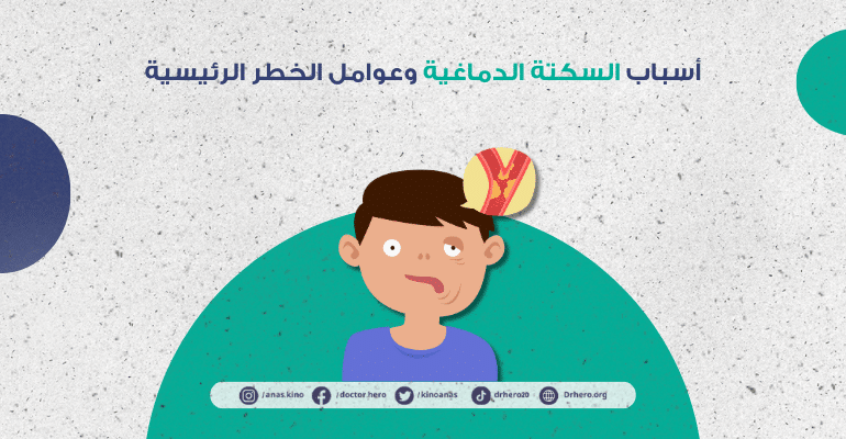 أسباب السكتة الدماغية وعوامل الخطر