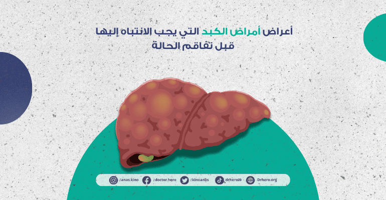 علامات مبكرة لأمراض الكبد