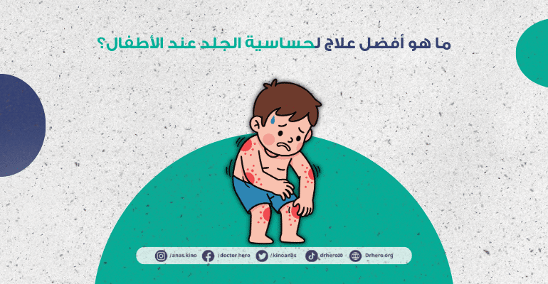 علاج حساسية الجلد المفاجئة عند الأطفال