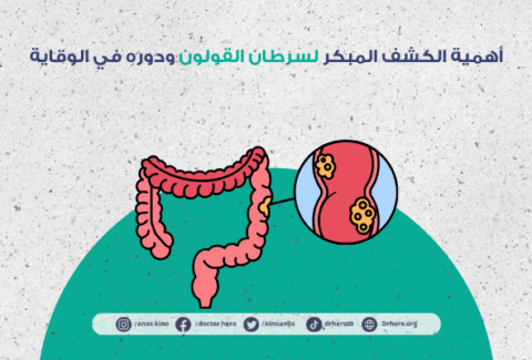 الكشف المبكر لسرطان القولون