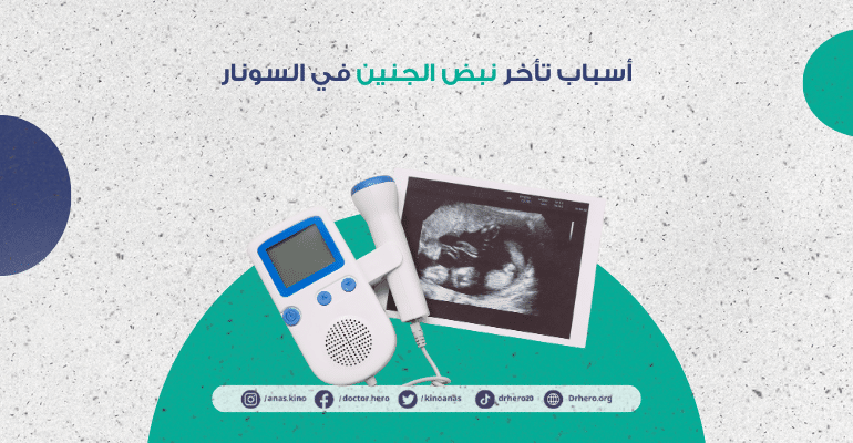 تأخر نبض الجنين في السونار