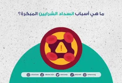 أعراض انسداد الشرايين المبكرة
