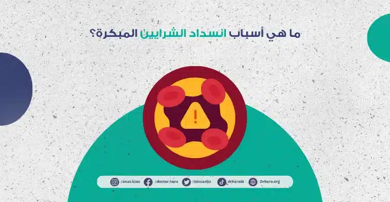أعراض انسداد الشرايين المبكرة