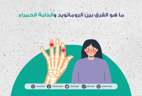 الفرق بين الذئبة الحمراء والروماتويد