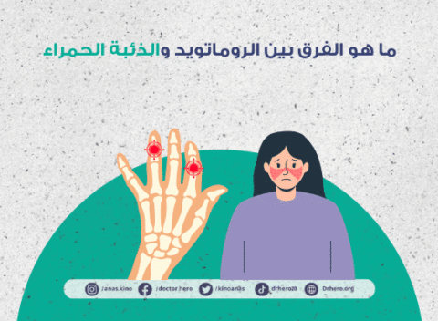 الفرق بين الذئبة الحمراء والروماتويد