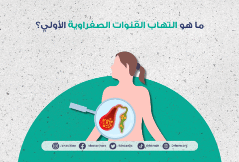 التهاب القنوات الصفراوية الأولي