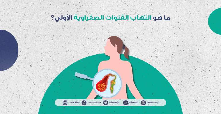 التهاب القنوات الصفراوية الأولي