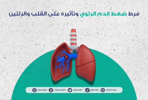 فرط ضغط الدم الرئوي