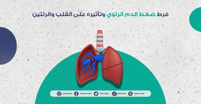 فرط ضغط الدم الرئوي