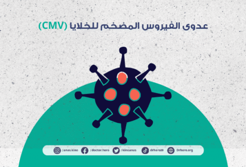 عدوى الفيروس المضخم للخلايا (CMV)