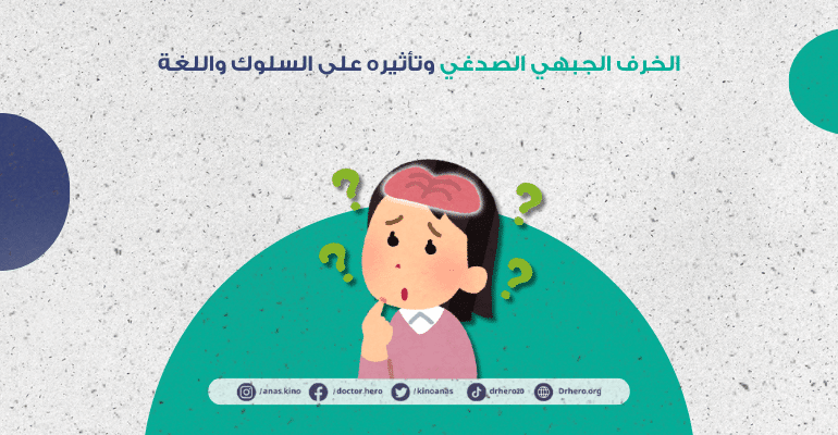 الخرف الجبهي الصدغي