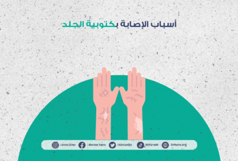 كتوبية الجلد