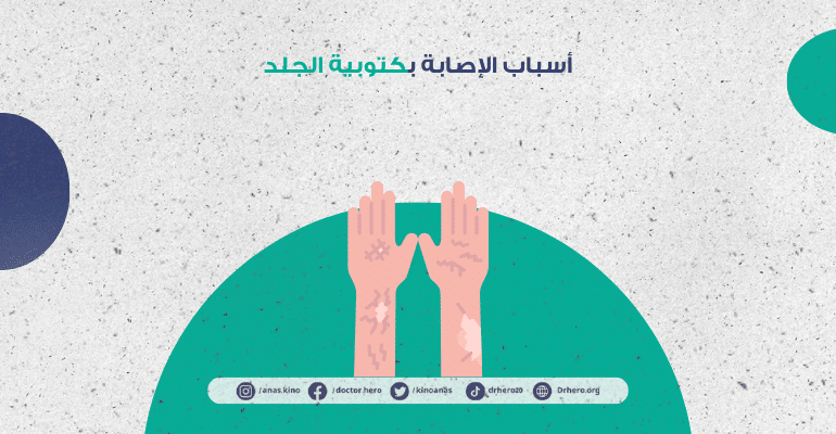 كتوبية الجلد