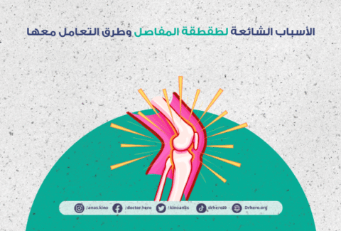 أسباب طقطقة المفاصل