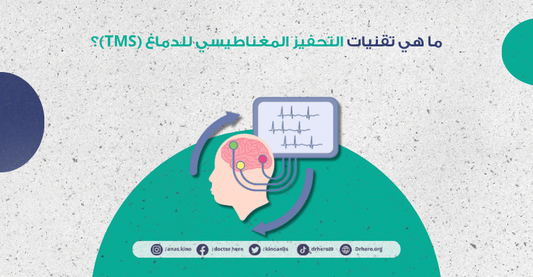 تقنيات التحفيز المغناطيسي للدماغ