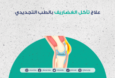 علاج تآكل الغضاريف بالطب التجديدي