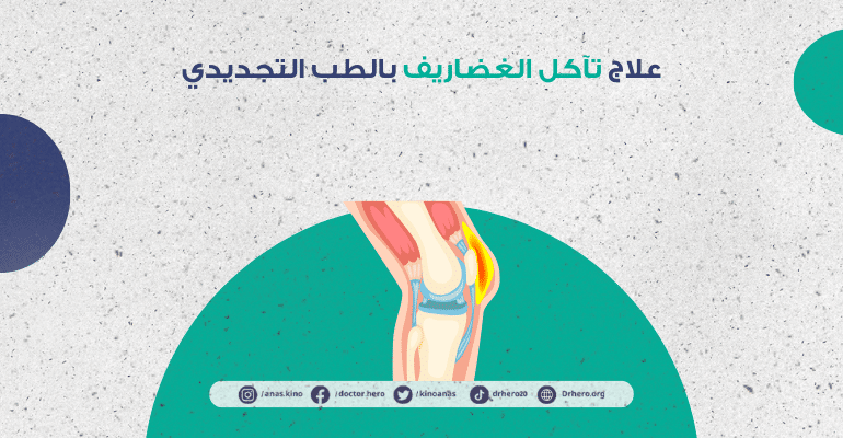 علاج تآكل الغضاريف بالطب التجديدي
