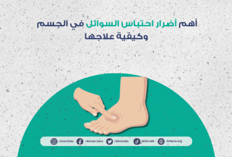 أضرار احتباس السوائل في الجسم